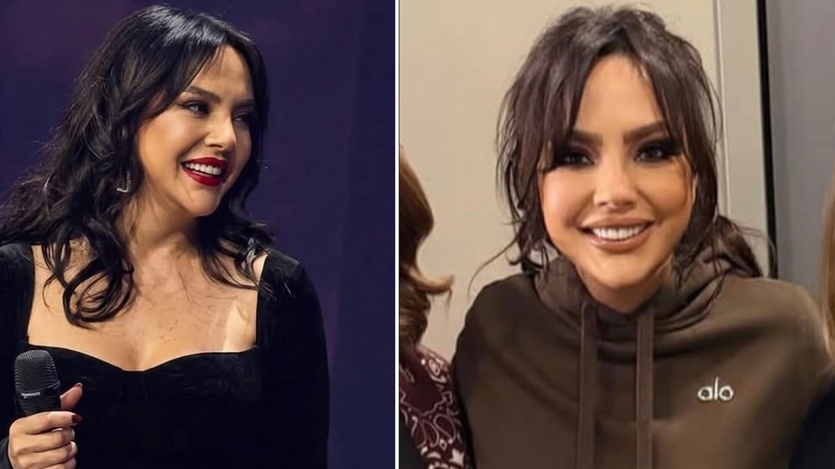 Ebru Gündeş’in estetik sonrası değişimi gündem oldu: Kıvanç Tatlıtuğ ile rol almak istiyor